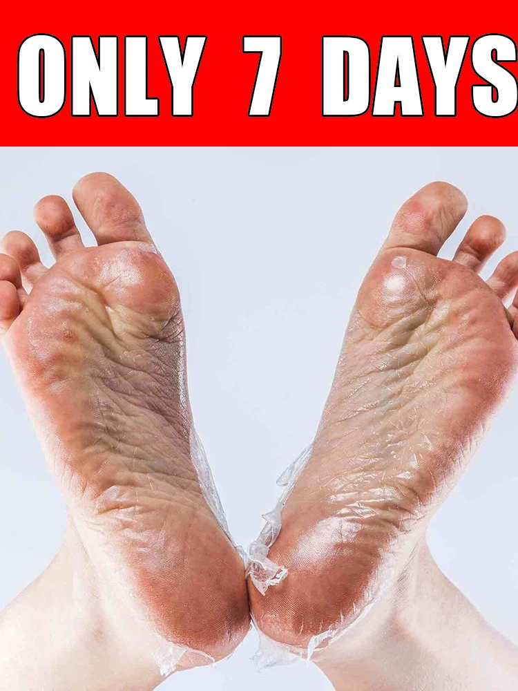 

7-Day Foot Exfoliating Spray, suitable for dry, rough, cracked feet, heels, and calluses.