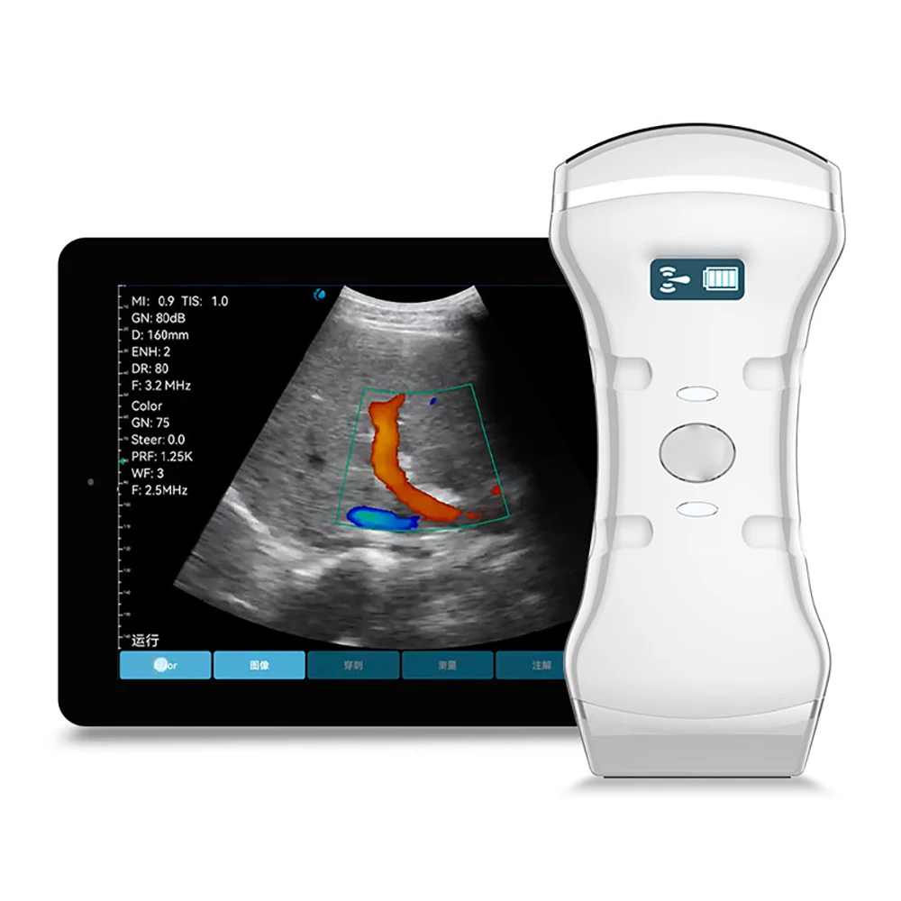 3 IN 1 Wireless Color Doppler Ultrasound Cardiac Abdomen Linear Array Probe 3-in-1 Wireless Ultrasound Scanner