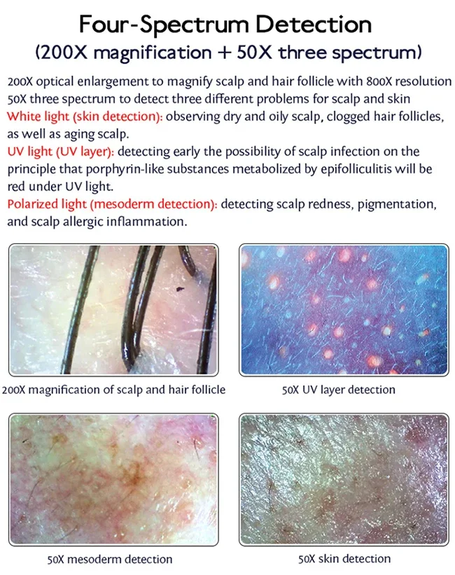 고품질 HD 3D 휴대용 두피 스캐너 감지기 3D 헤어 분석기 기계 IT 얼굴 두피 분석 바디 눈 코 EU ZA