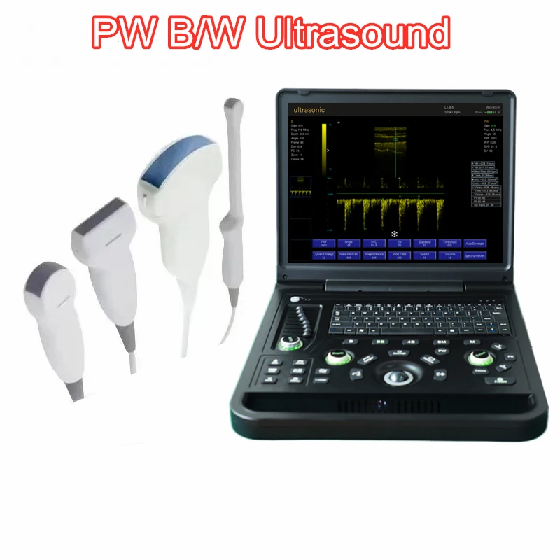 15 Inch Large LED Screen PW ARM System Notebook Ultrasound USG Scanner Echo Machine