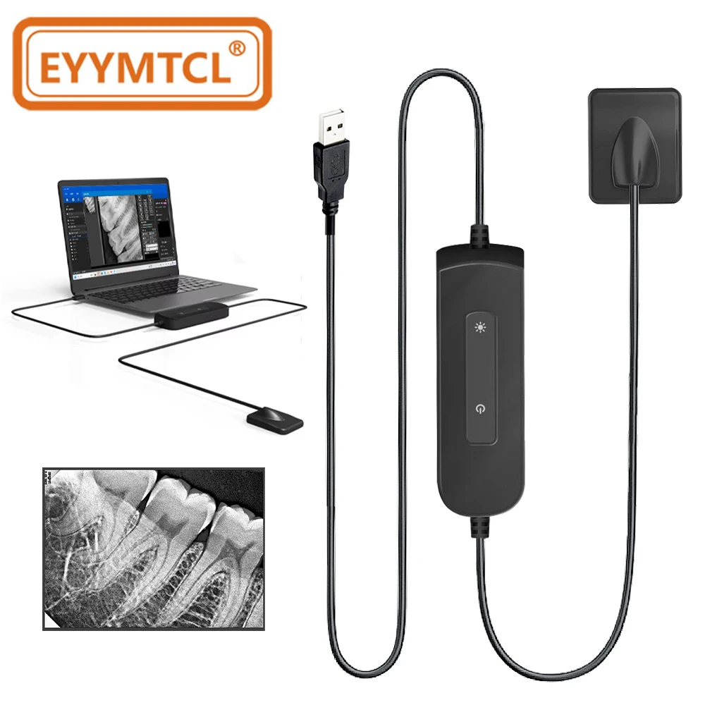 EYY Sensor Dental con IA, Máquina de Rayos X de Alta Frecuencia, Sistema de Imágenes HD, Radiovisiógrafo Dental DynImage, Sensor Intraoral Digital de Rayos X