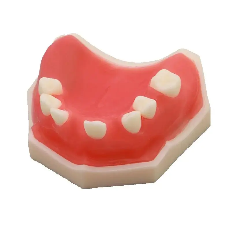 High Quality Dental M2009 Implant Practice Model for Medical Demonstration