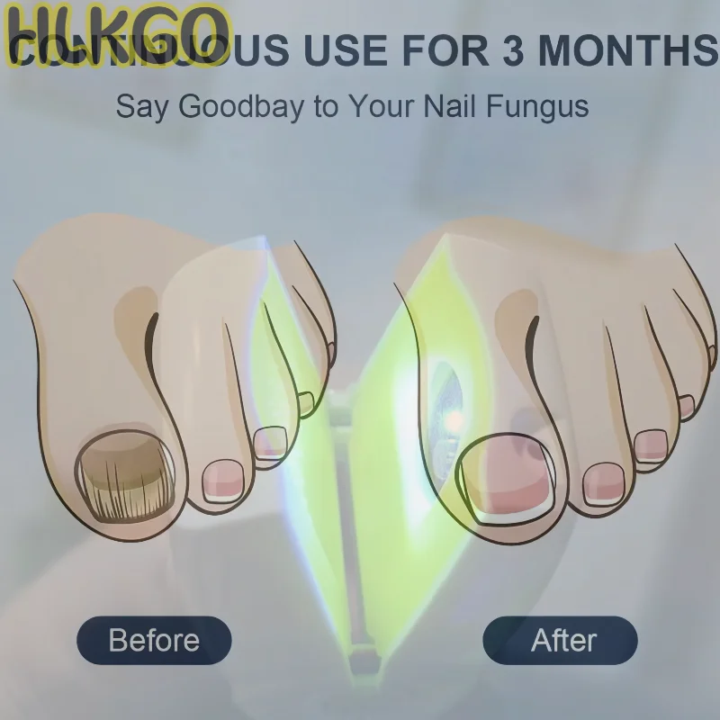 

Лазерное устройство грибка ногтей с лампой для фототерапии, профессиональный серый инструмент для помощи ногтей 2-в-1, зарядка типа C