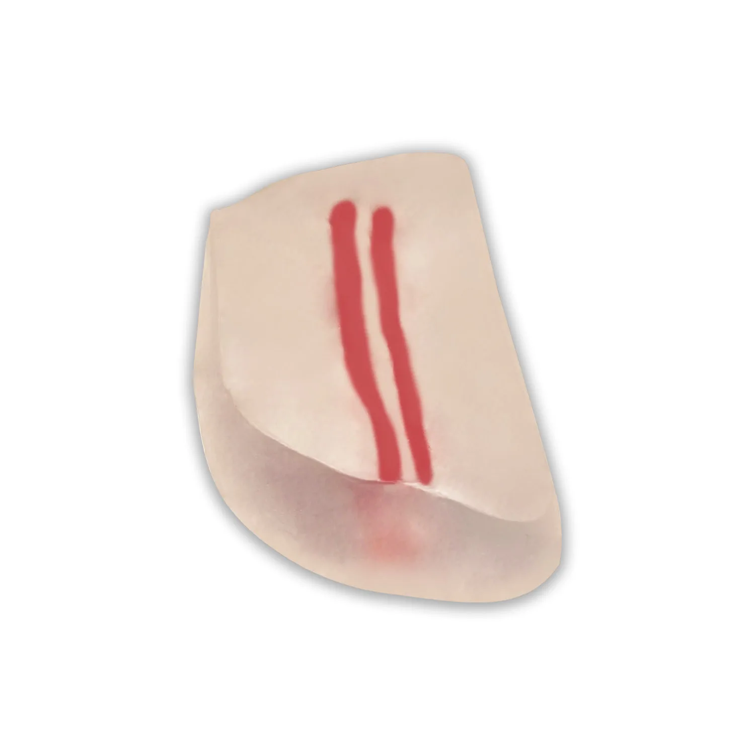 

ultrasound-guided femoral arteriovenous puncture and catheterization education