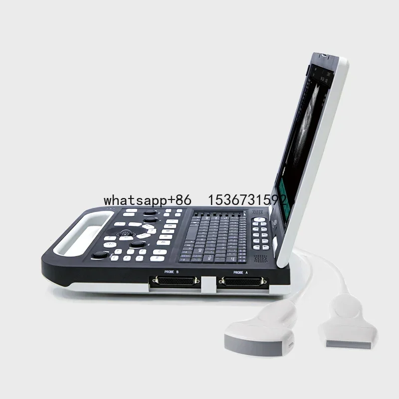 B-ultrasonic portable color doppler digital ultrasound machine diagnostic equipment+line array probe