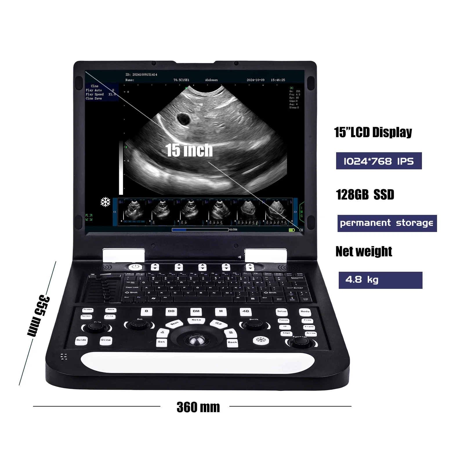 Portable Ultrasound Veterinary Machine Vet Ultrasound Equipment for Clinics Hospital Veterinary Ultrasound Solutions Available