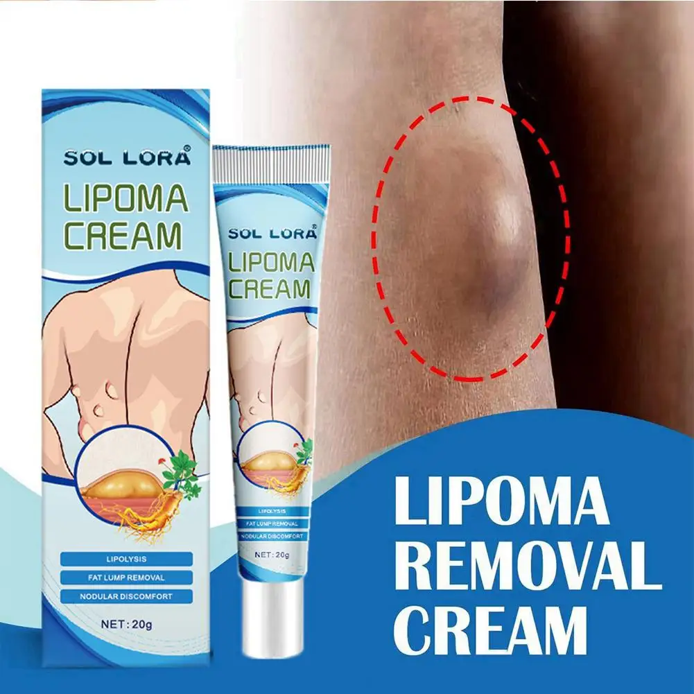 5pcs Lipoma Remove Cream Body Care Cream Relieve Lipoma Fat Lumps And Subcutaneous Lumps Fibroid Removal Reduce Inflammation New