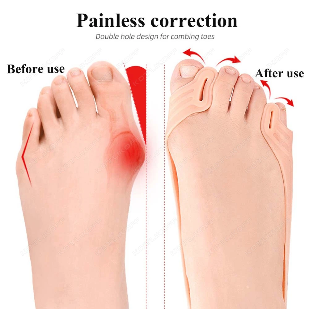 Silicone 2 Hole Toe Separator For Hallux Valgus Protector Flexible Wear-Resistant Exercise Rally Band Pain Relief Forefoot Pads