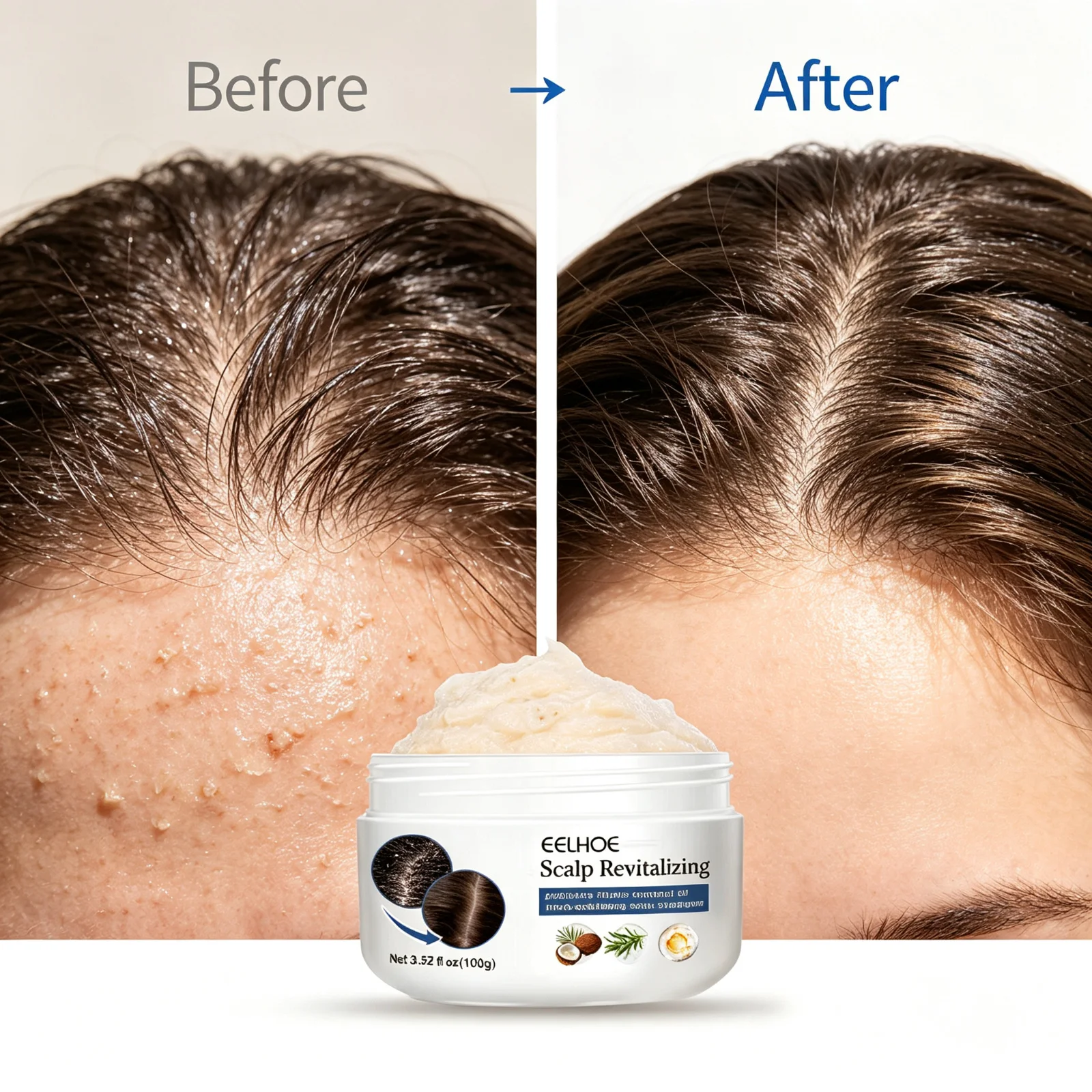 Scrub esfoliante per il cuoio - Hair Care Dandruff recensione e prezzo