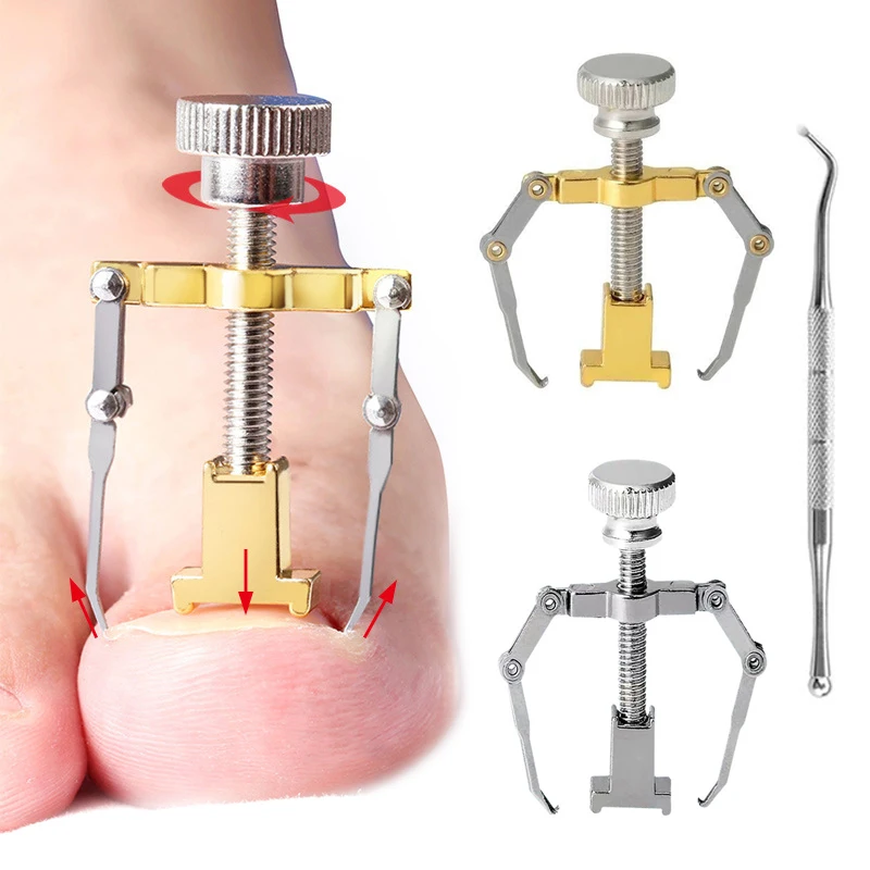 Medical Ingrown Toenail Correction Brace Kit Professional Toe Nail Care Pedicure Manicure Clipper Fixer Recover Corrector Tool