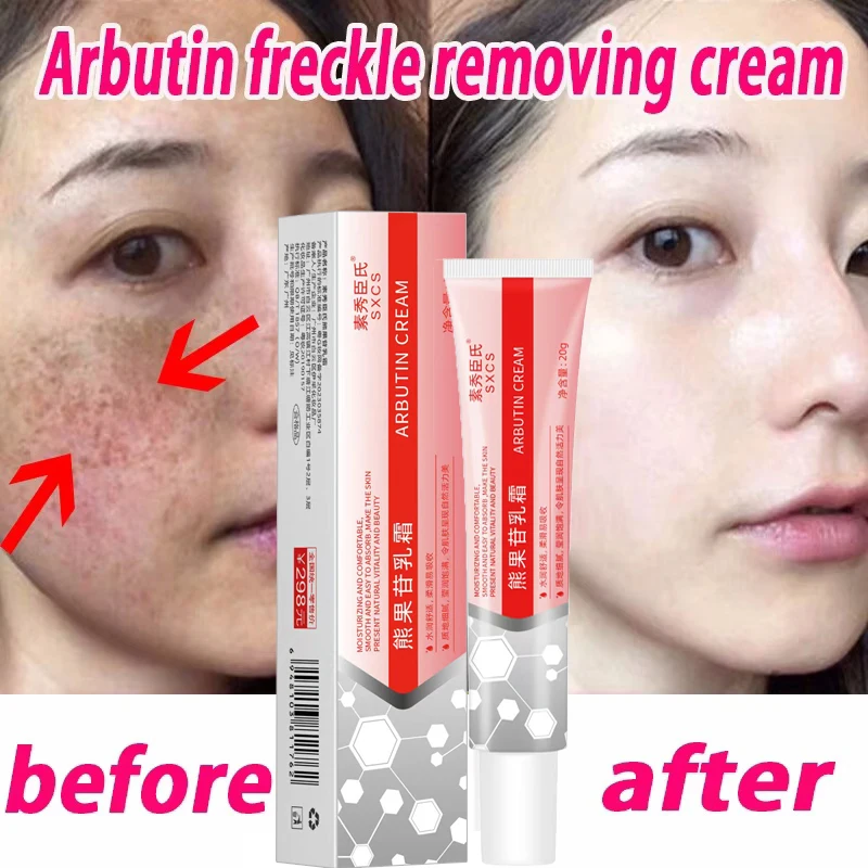 New Removal Melasma Freckle Face Cream Dark Spot Remove Whitening Fade Pigmentation  Improve Dullness Moisturize Beauty-health