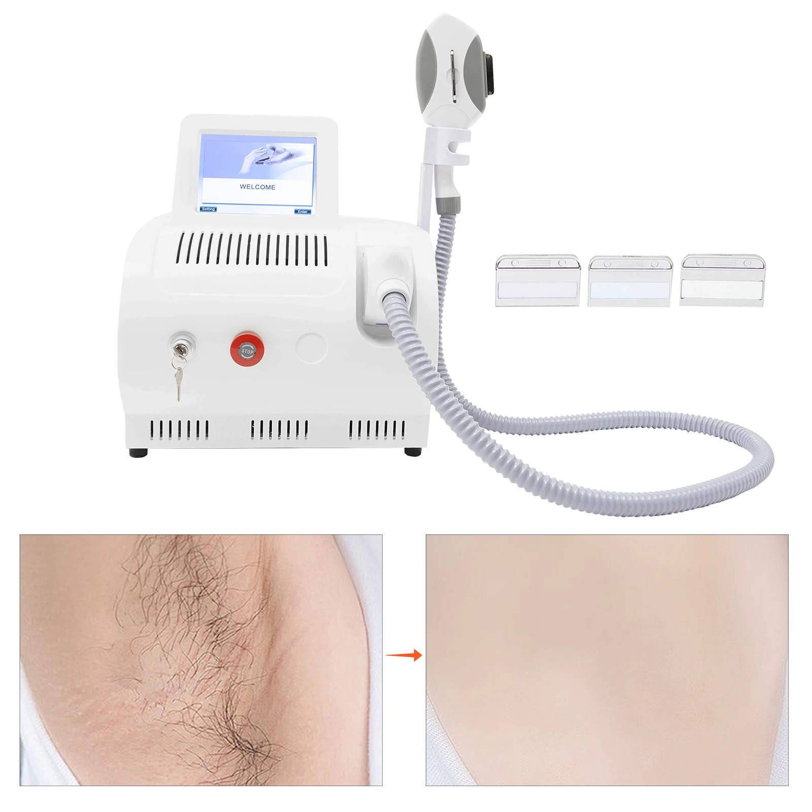 2KW RF Skin Rejuvenation Machine OPT PRO Elight IPL Laser Hair Removal Machine Permanent