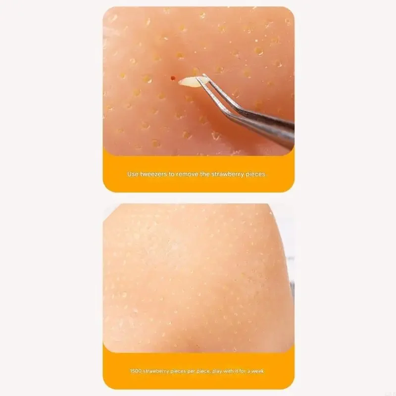 สมจริง Elastomer สิวเปิด Ease ของเล่นความแม่นยำ Pincers และขนส่งกระเป๋าสำหรับผู้ใหญ่เด็ก Perceptual 15UB