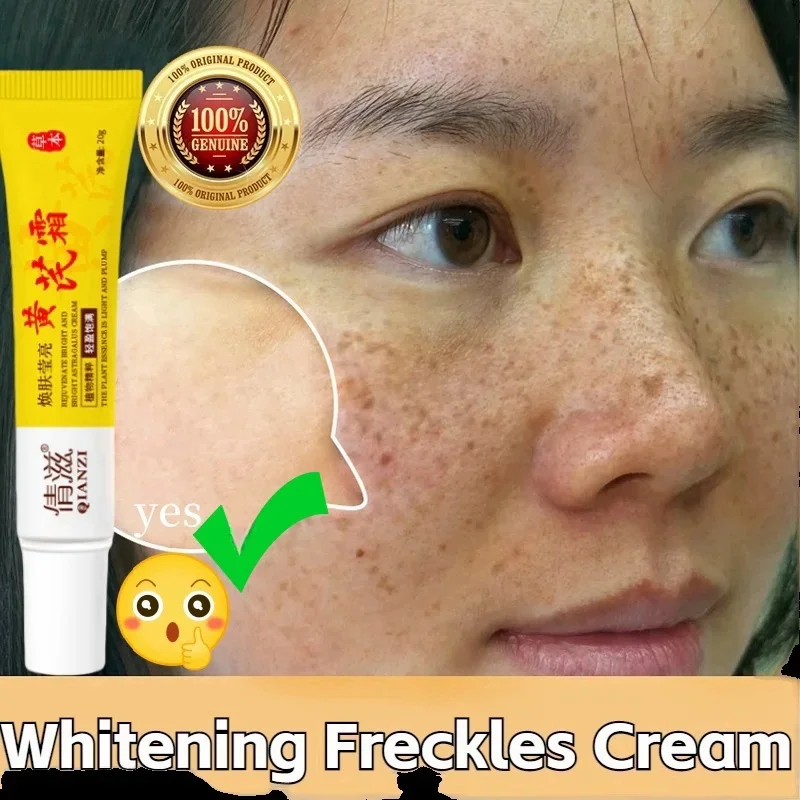 Face Brightening Cream Niacinamide Reduce Chloasma Melasma Melanin Fade Fine Lines Lighten Dark Skin Serum Care Brighten Cream