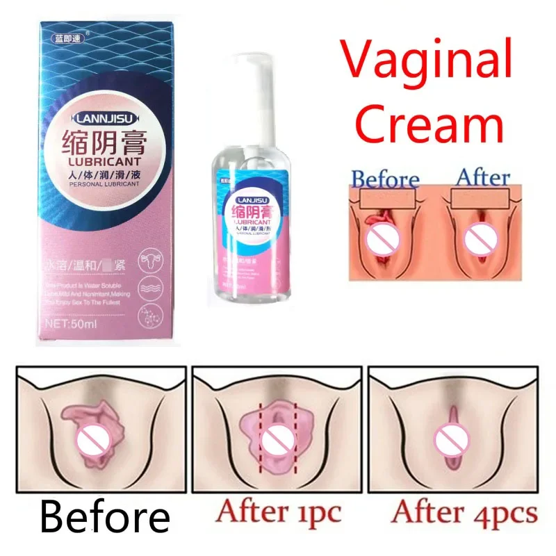 Gel de aperto vaginal para mulheres, creme vaginal, lubrificante de aperto Afrodisíaco