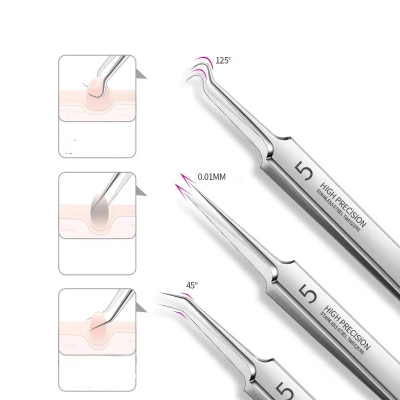 Herramientas profesionales para el cuidado de limpieza de poros faciales, juego de agujas para espinillas y acné, herramienta facial suave para eliminación de espinillas y estampado de espinillas, 3 uds.