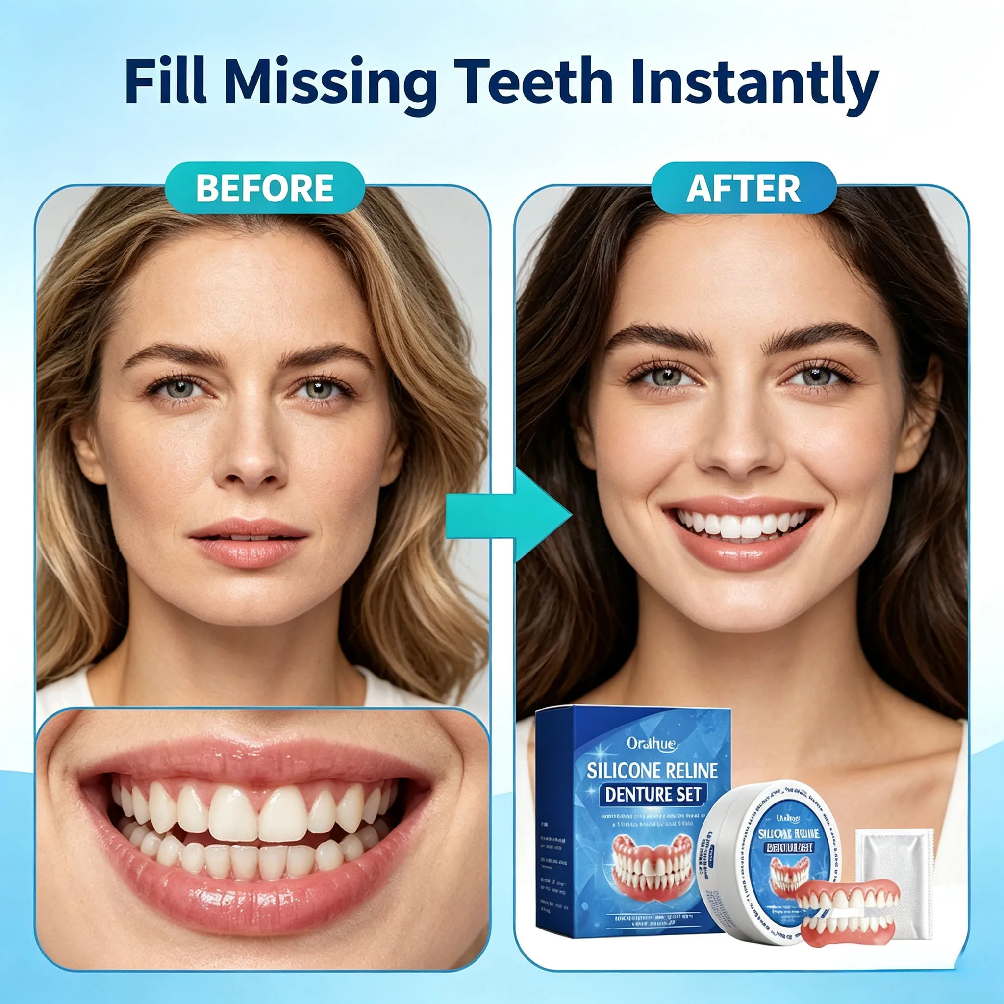 Dentaduras de Silicone para Qu - Teeth Whitening Veneers avaliação e preço