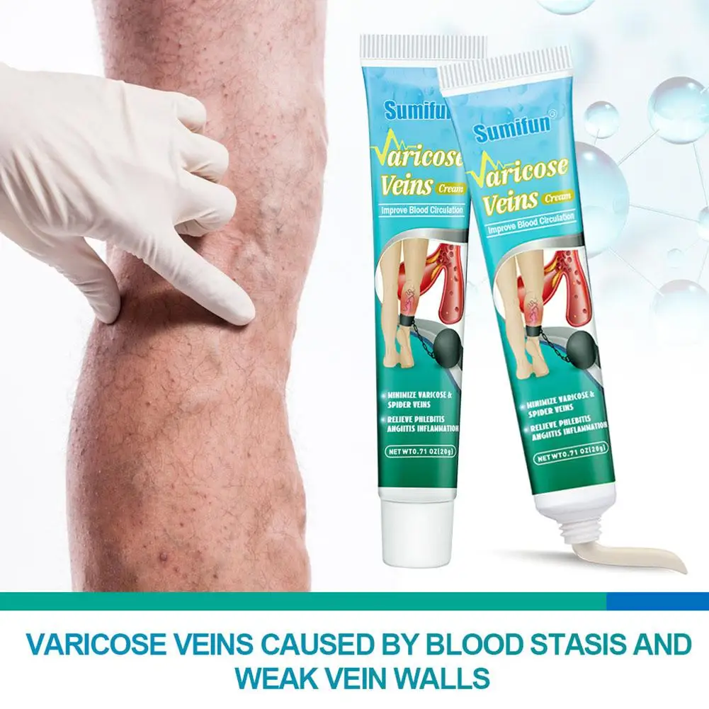 Varicose Vein Relief ,Improve Blood Circulations Spider Varicose Vein For Tired Heavy Legs Fast Relief G2A9