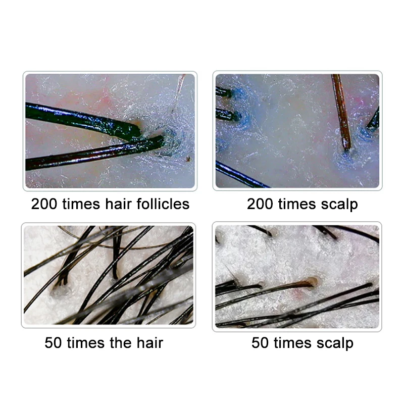200/50X Haut Haar Kopfhaut Detektor Dermaskop Für Haut Scanner Maschine Digital Mikroskop HD Haar Follikel Haut Analysator 10 zoll