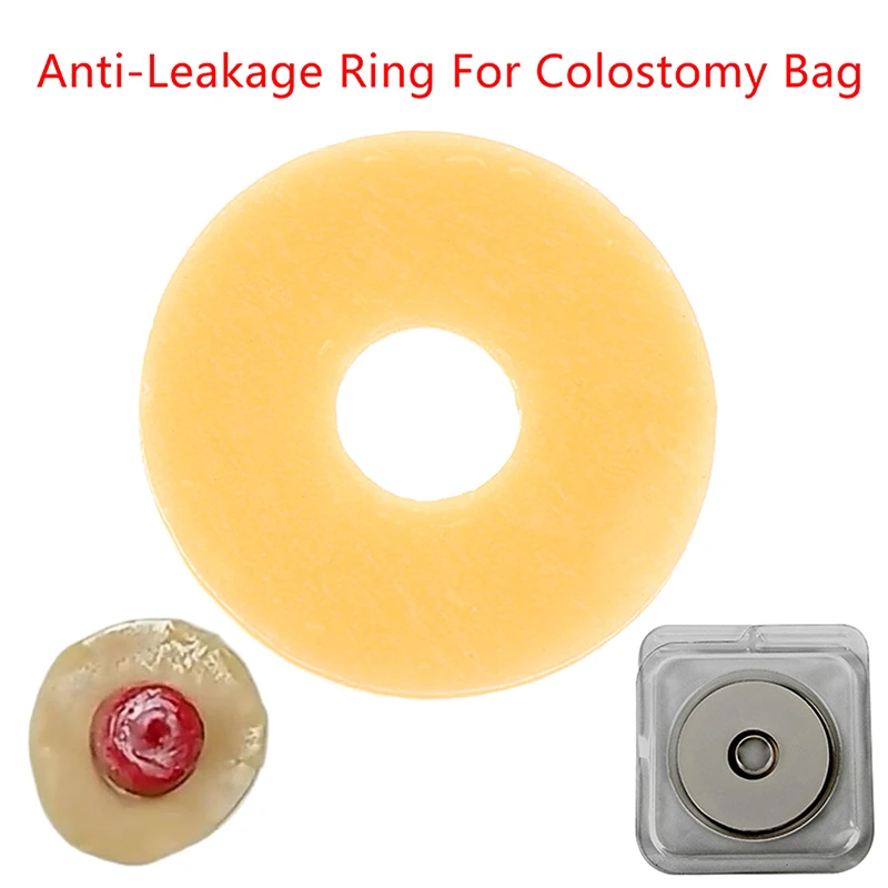 1PCS Anti-Leakage Ring For Colostomy Bag Ostomy Paste Ring Baseplates Stoma Care Products To Prevent Leakage Protect Skin