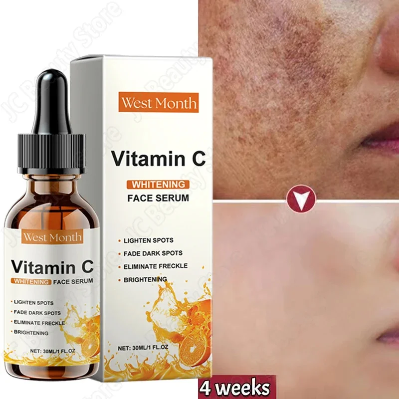 Vitamin C Whitening Serum Remove Freckles Dark Spots Face Essence Fade Melasma Melanin Brighten Repair Dull Skin Care Cosmetics