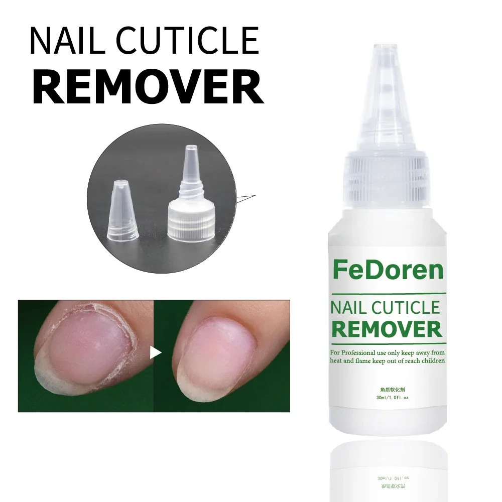 30ML Nail Cuticle Remover ammorbidente liquido per la riparazione delle unghie Gel esfoliante trattamento per cuticole Manicure ammorbidire la pelle morta per la cura delle unghie