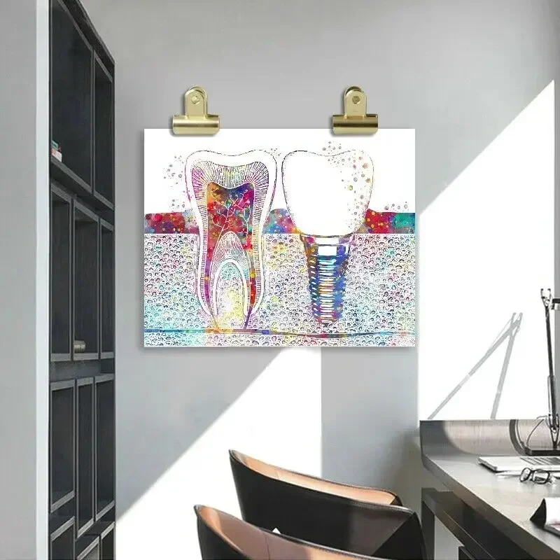 Tooth Implant Dentist Hospital Dental Clinic Medicine Wall Art Pictures Posters Canvas Paintings Room Decorations Home Decor