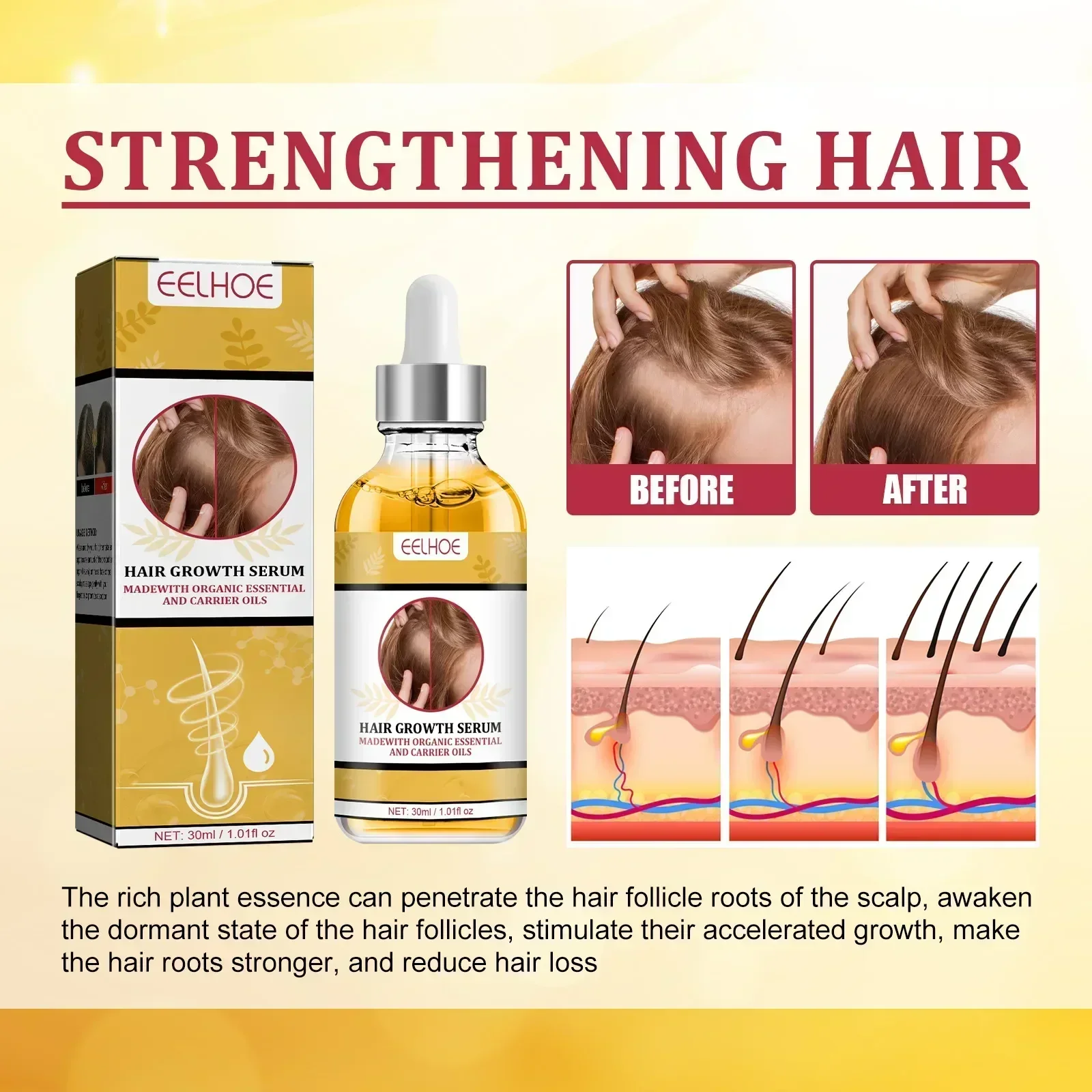 Fast Hair Growth Oil Repair Hereditary Hair Loss Postpartum Seborrheic Hair Loss Oil Rapid Growth Care