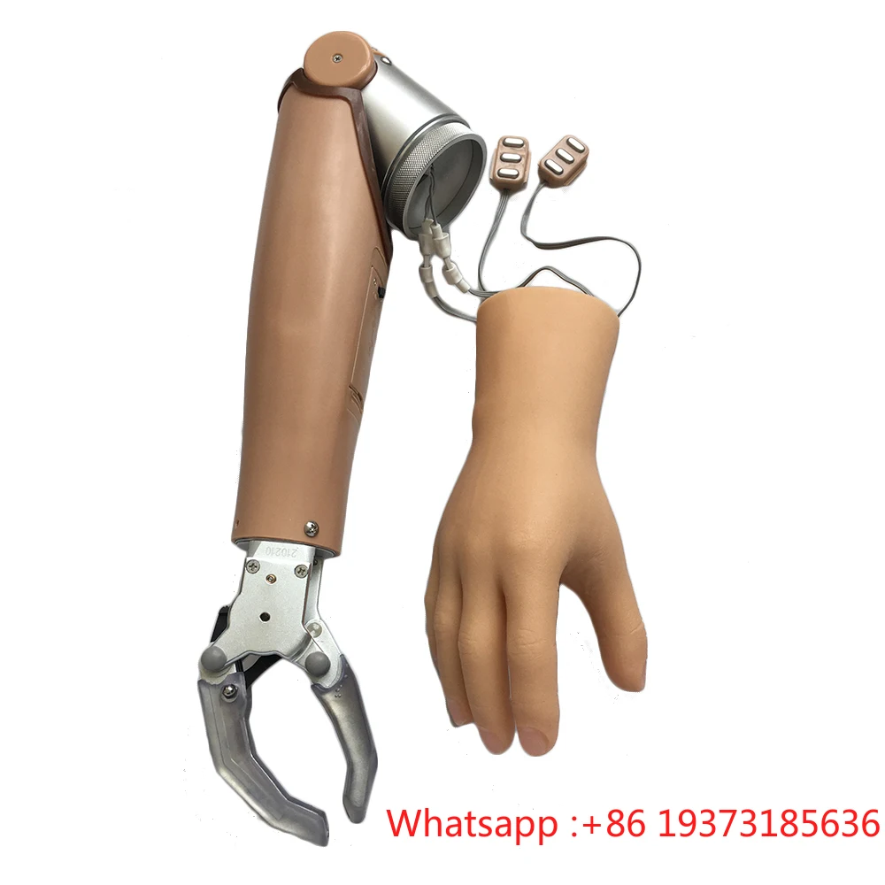 Myoelectric Arm Prostheses With Two Degrees Of Freedom For AE Prosthetic Hand