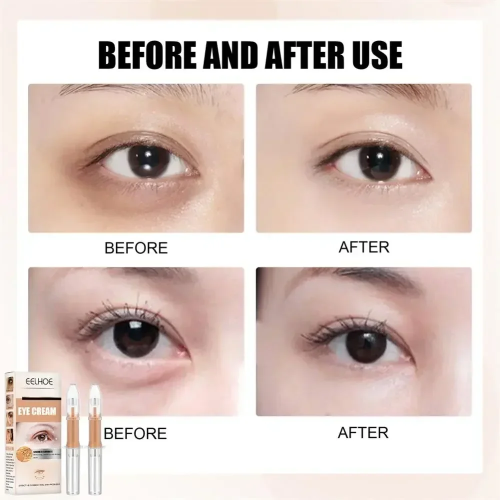 Instantly Eye Cream Eye Bags Removal Against Puffiness Long Lasting Turns Wrinkles Anti-wrinkle Eyes Care Serum