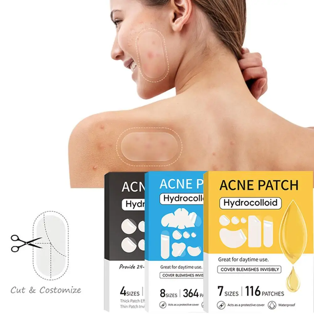 Acne Patch Mild Non-irritating Lightens Acne Hydrocolloid Acne Stickeres For Forehead Cheek Back Blackheads Closed Comedones