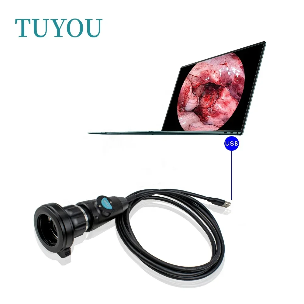 Portable USB endoscop camer with Medical Digital Surgical Fiberscope for ENT Nasal Otoscope