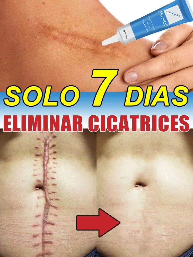 

no more scars