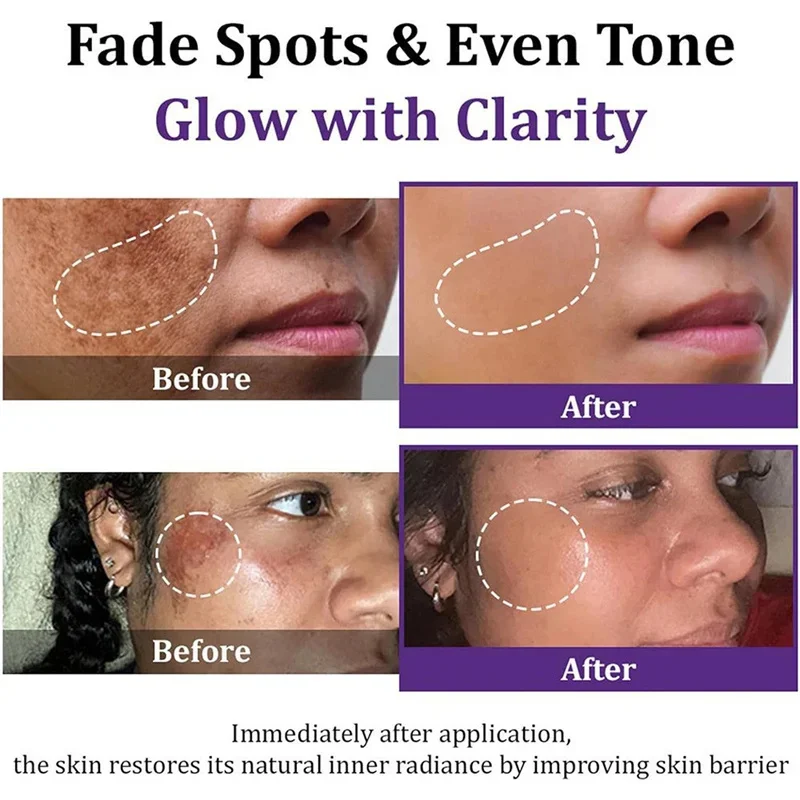 Crema schiarente per macchie Niacinamide Riduce cloasma Melasma Melanina Dissolvenza Linee sottili Dissolvenza Macchia scura Opaco Idratante Cura del viso