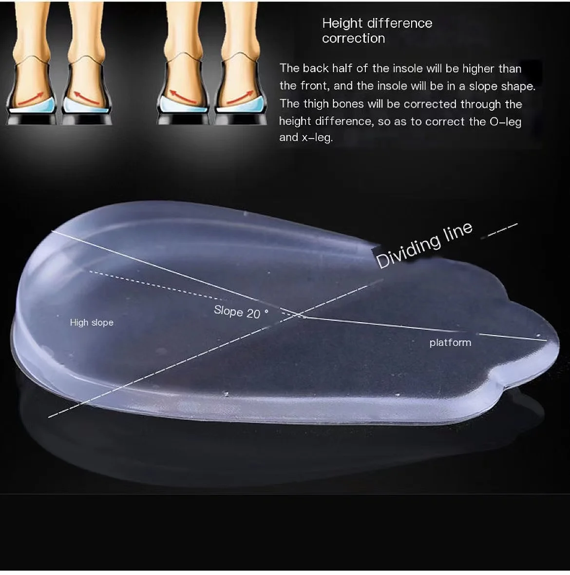 X/ O-shaped Leg Correction Insole Inside Eight Figure Outside Eight Straighten Healthy Beautiful Legs Correct Looped Legs