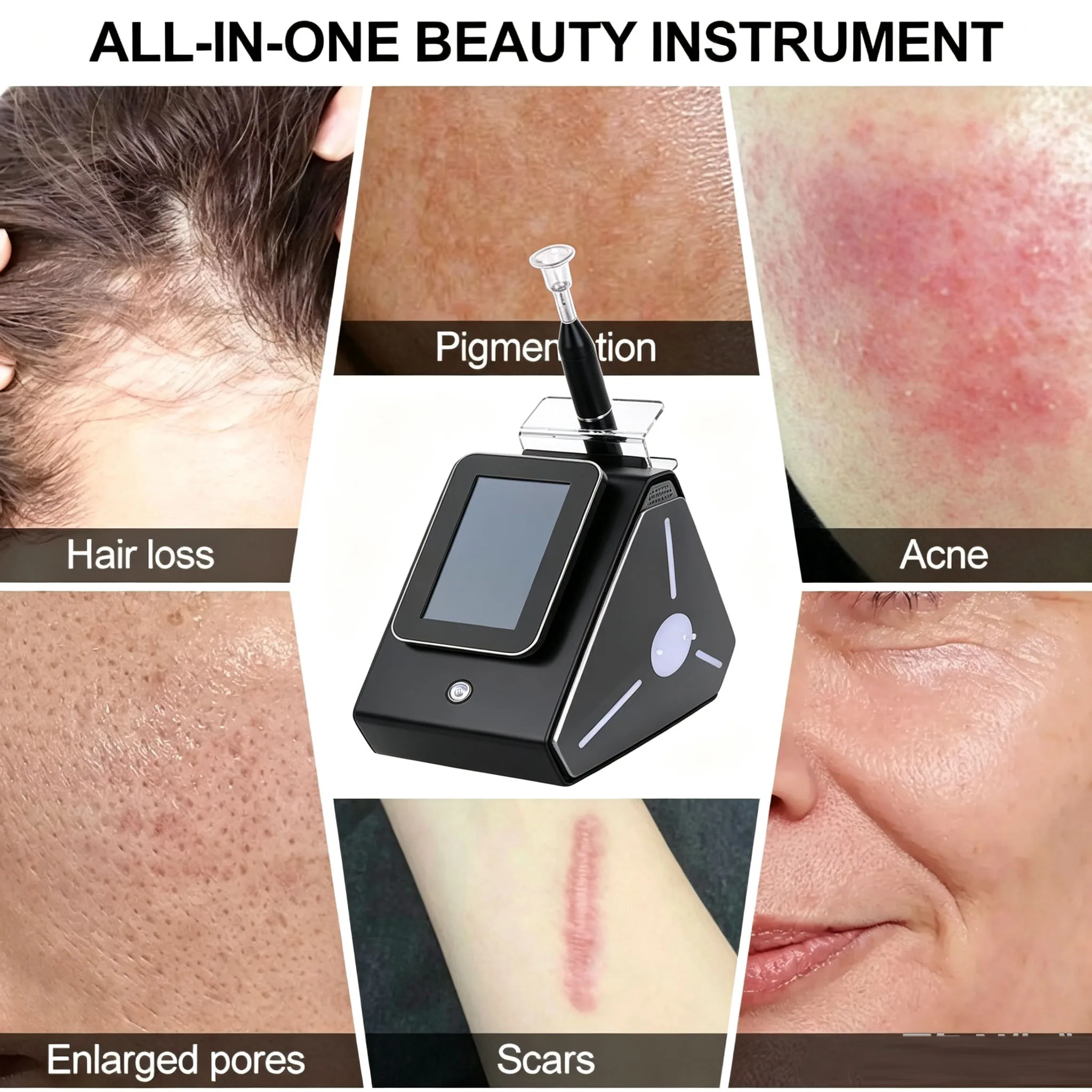 Cold Plasma Skin Rejuvenation and Soothing Comprehensive Skin Management Device for Beauty Salons