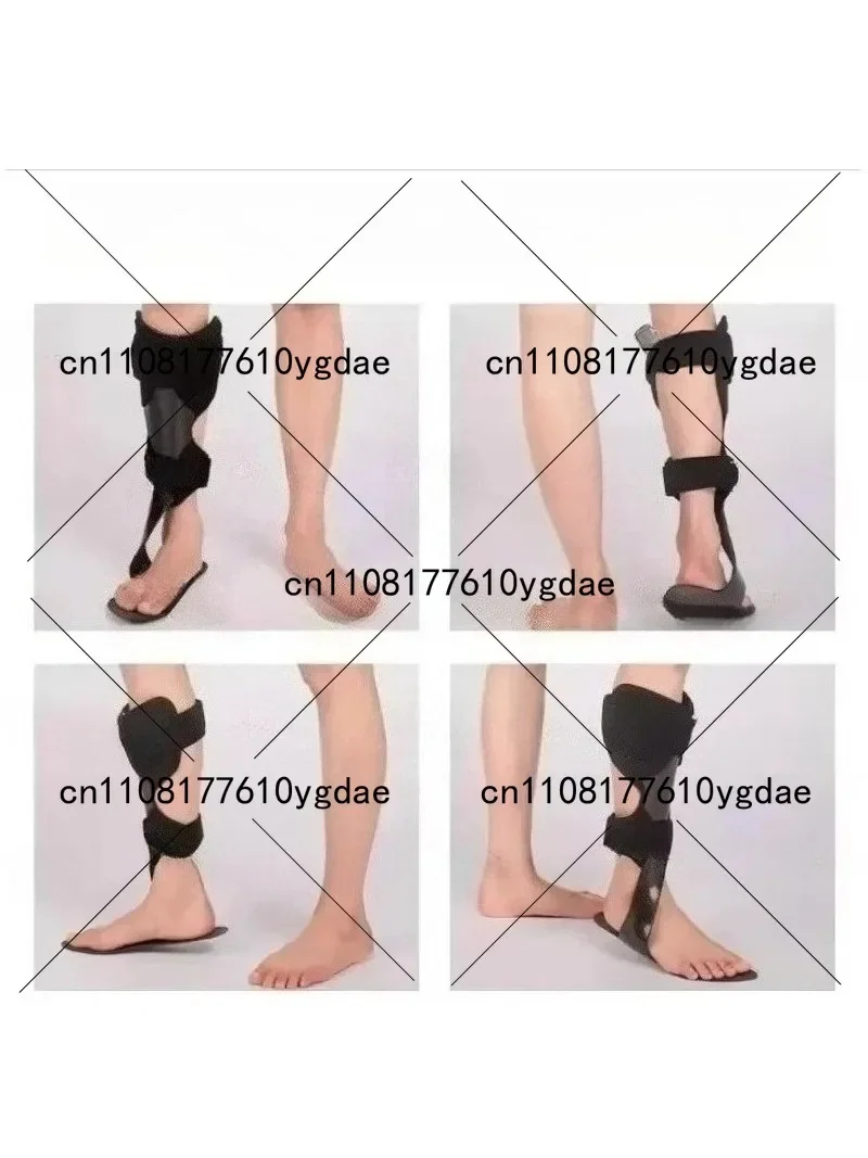 High Quality Carbon Fiber Ankle Orthosis Step-Type Intelligent Fall Prevention Brace for Foot Support