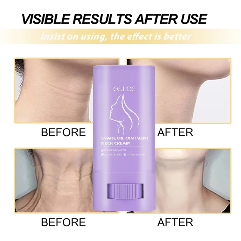 Snake Oil Neck Cream Moisturising Lift Neck Eliminate Double Chin Eliminate Neck Fine Lines Anti-ageing Brightening Ointment New