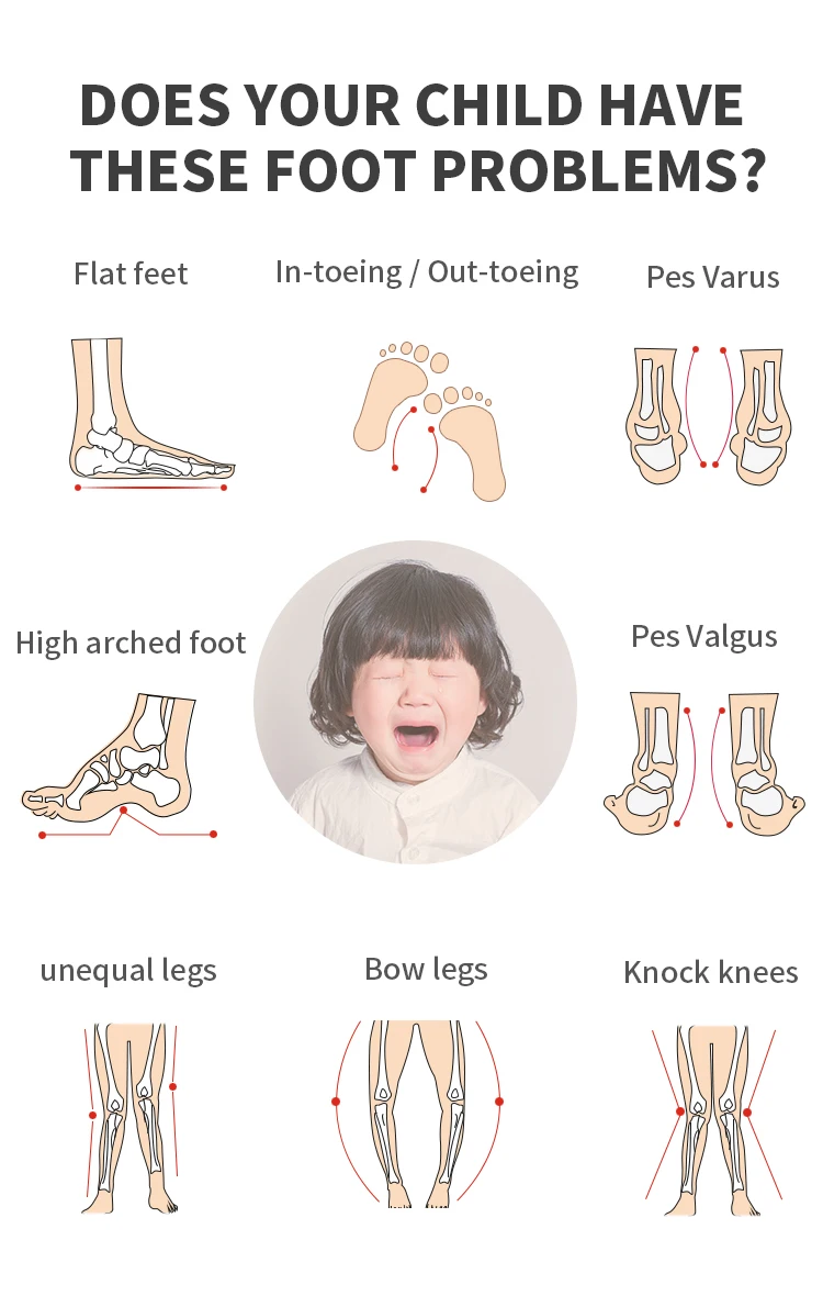 Orthopedische Sneakers Voor Kinderen En Peuters, Corrigerende Schoenen Met Arch Ondersteuning, voorkomen Jongens En Meisjes Platte Voeten Tenen Lopen