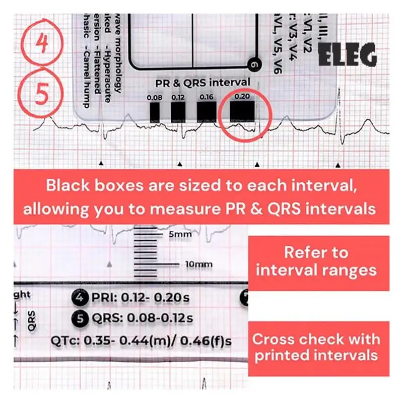 

ELEG-2PCS ЭКГ 7-ступенчатая линейка ЭКГ 7-ступенчатая линейка для ЭКГ 7-ступенчатая линейка ЭКГ-линейка, портативный инструмент оценки ЭКГ-карта