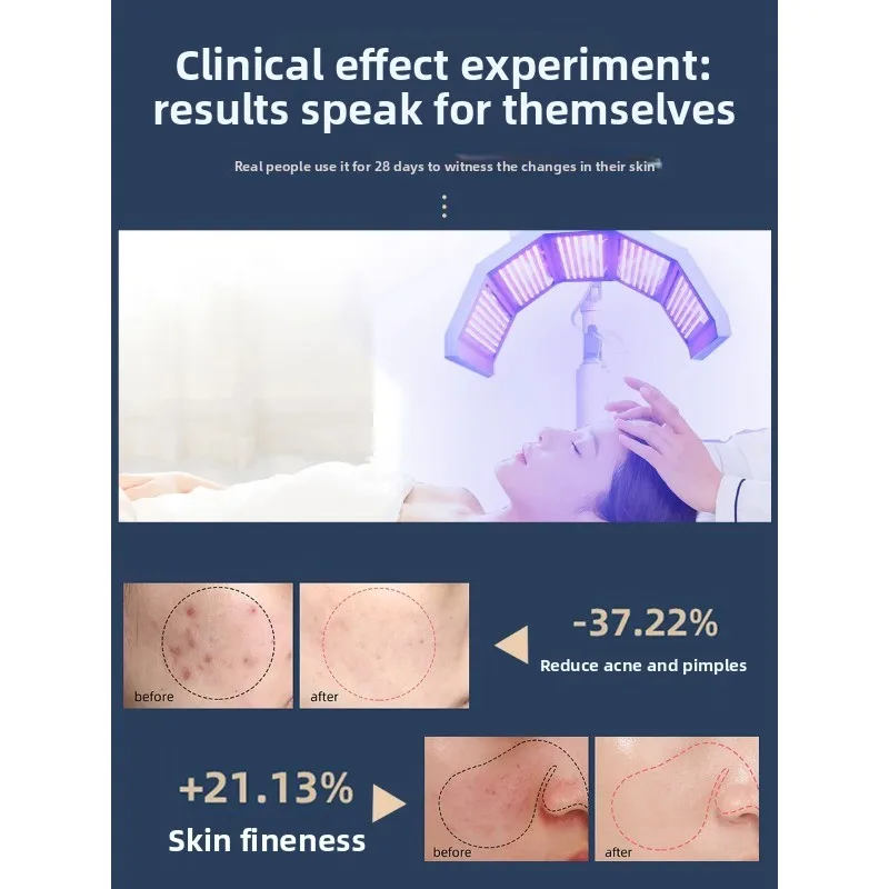 Three-Color Color Light Skin Rejuvenation Light Spot Spectrometer Collagen Skin Beauty Phototherapy Instrument Beauty