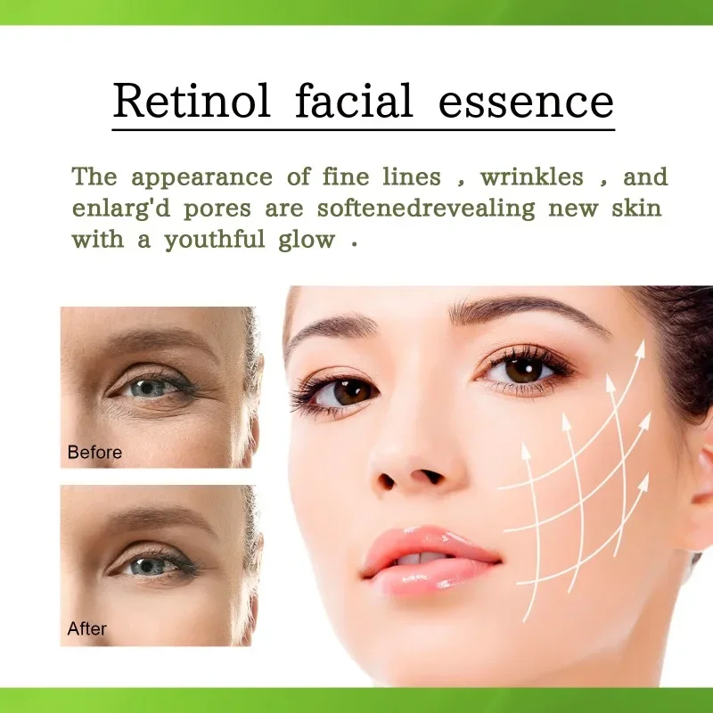 Suero Facial con Retinol, esencia blanqueadora antiedad, antiarrugas, ilumina la cara, cuidado de la piel, Lifting, reafirmante, desvanecimiento de los ojos, hidratante de líneas finas