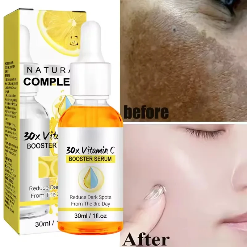 

VC Whitening Freckles Face Serum Effective Remove Dark Spots Fade Melanin Improve Dullness Brighten Repairing Skin Care Product