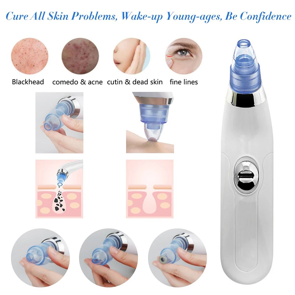 Electric Vacuum Blackhead Remover Pore Acne Black Spots Point Cleaner Extractor Machine Nose Facial Skin Care Tool Sucker Kit