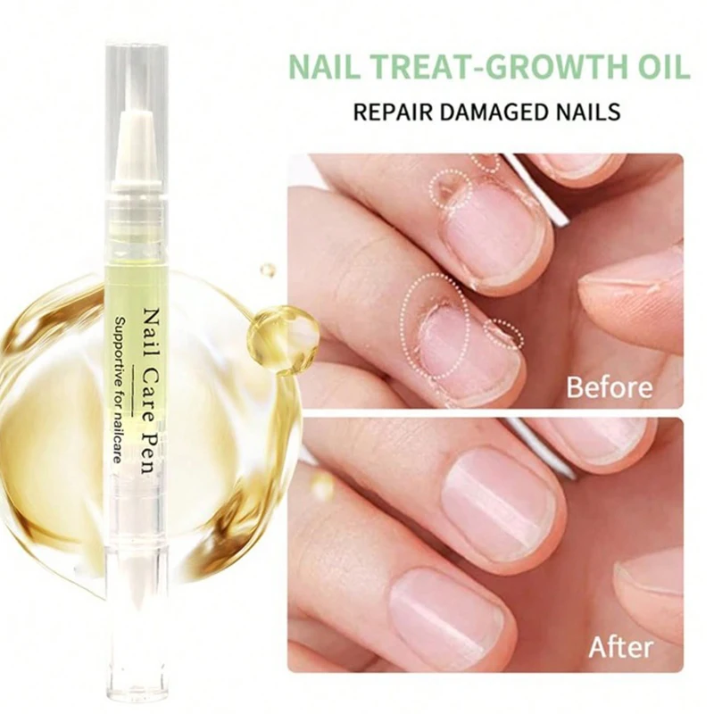 2ml Nail Cuticle Oil Pen Revitalizer Oil Applicator Nail Edge Nourishment Treatment for Manicure Prevent Hangnails Agnail Anti‑barb Nourishing Fingernails Professional Finger Nail Care Beauty Tool
