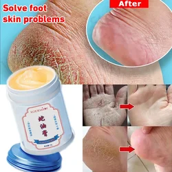 Moisturizing Anti-Drying Crack Foot Cream Heel Cracking Repair Exfoliation Dead Skin Removal Softening Smooth Skin Care Products