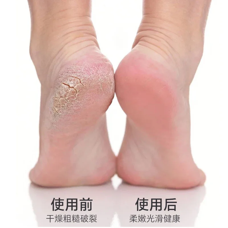 Electric Foot Callus Remover Foot Care File Heels Dead Skin Pedicure Tool Electronic Foot Grinder and Replacement Sandpaper