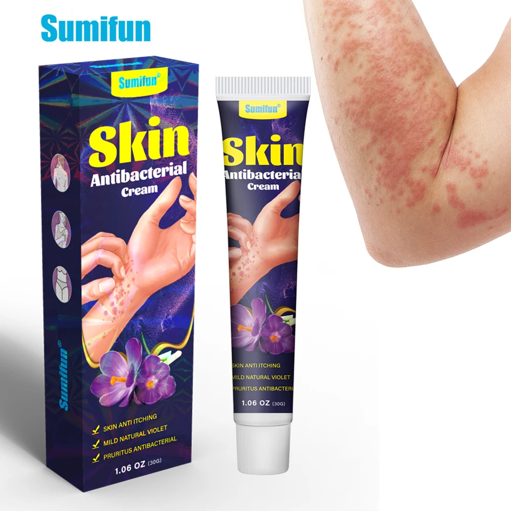 

30G Sumifun Psoriasis Cream Treat Anti-Itch Tinea Pedis Antibacterial Urticaria Ointment Dermatitis Eczema Rash Skin Health Care