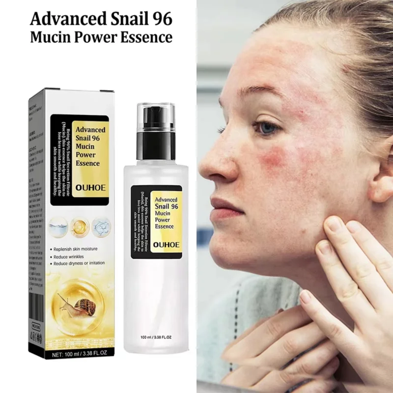 Esencia de poder de colágeno de caracol, barrera reparadora de la piel, esencia líquida hidratante, desvanecimiento de manchas oscuras, brillo, cuidado de la piel, 100ml