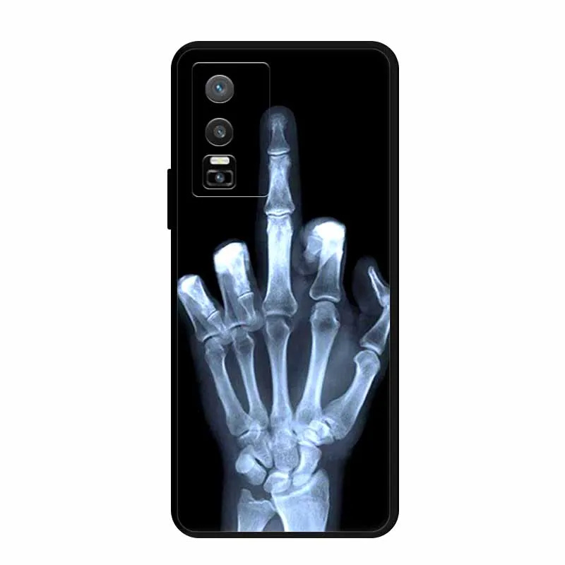 For Vivo Y76 5G Case Animals Soft Silicone TPU Phone Back Cover Coque for Vivo Y 76 5G Protector VivoY76 5G Bumper V2124 Funda